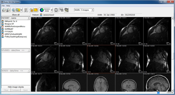 free download dicom image viewer for mac 10.5